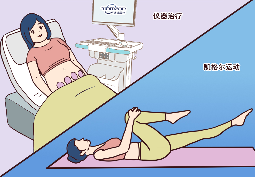 盆底肌修復儀器+運動指導，讓產(chǎn)后恢復更科學化、智能化、個性化