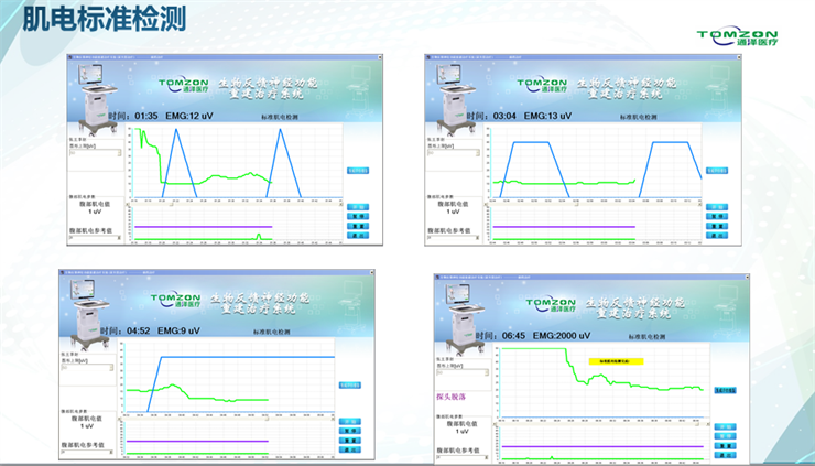 1565667720180612.png 盆底肌修復(fù)