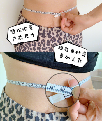 1576655392750172.png 腹直肌修復(fù)