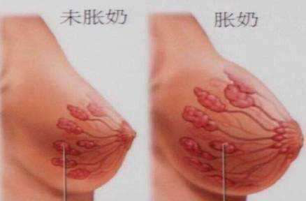 1587016962279606.png 通乳